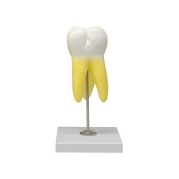 Molaire supérieur, 3 racines